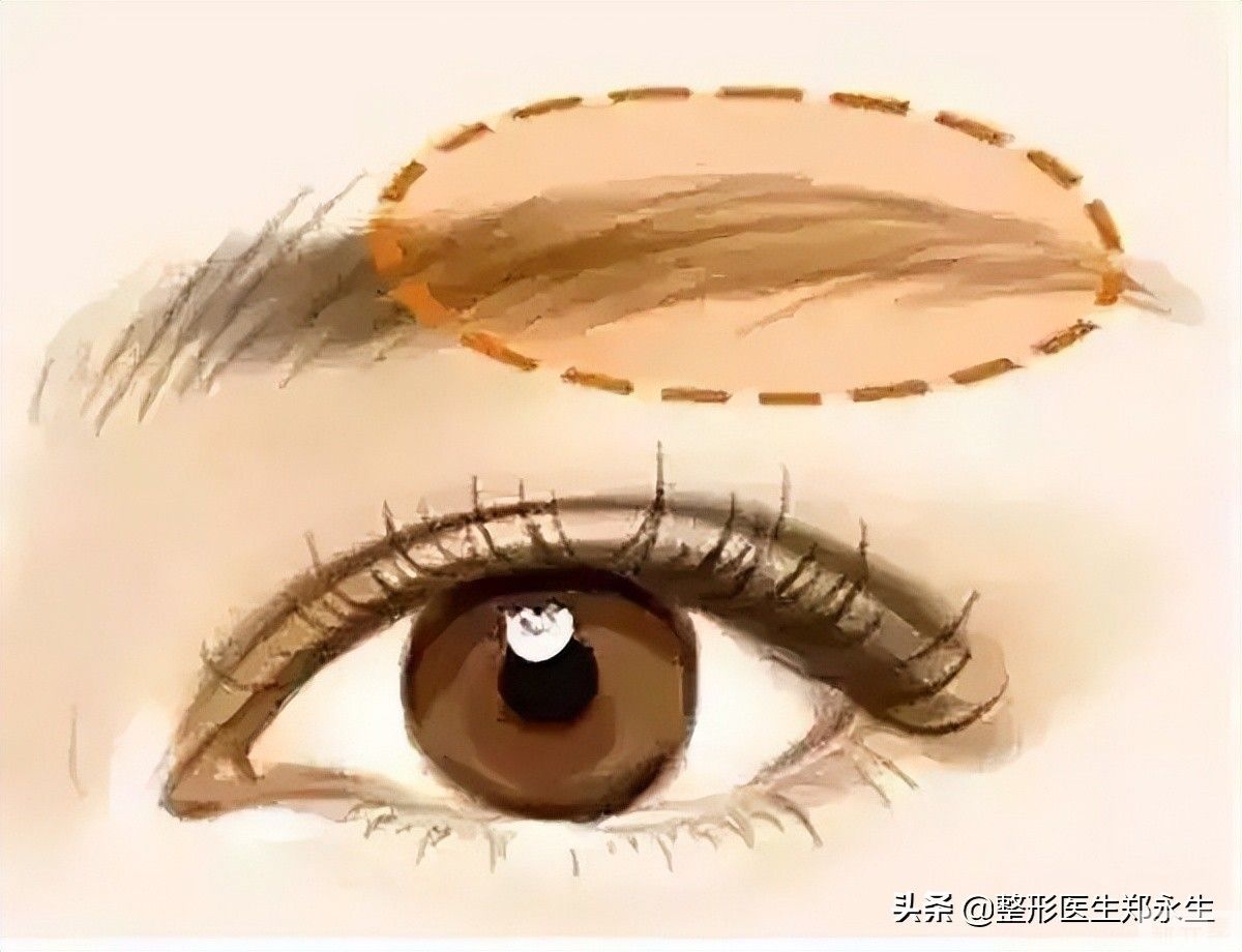 你的双眼皮为什么看起来假，看看你就知道了 图片-2