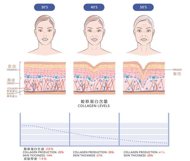 何谓“少女针”?它又有什么特别的地方? 图片-10