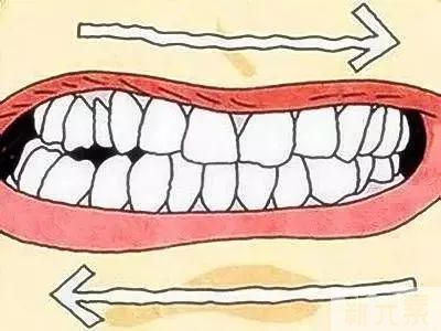 【名医请回答】矫正失败后，还能进行二次矫正吗? 图片-8
