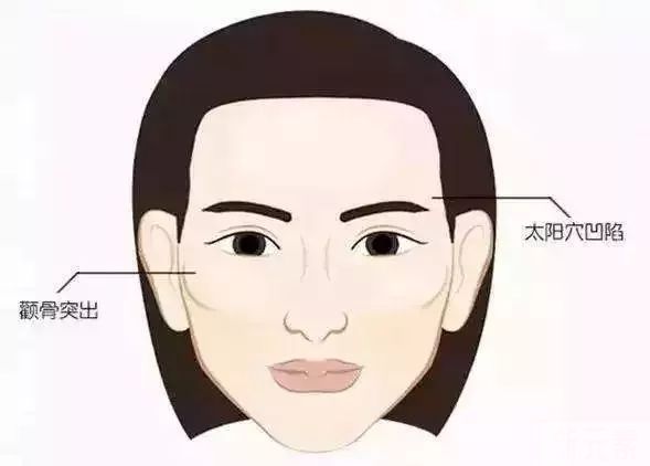 生怕脂肪填充后脸变大?答案大揭秘! 图片-7