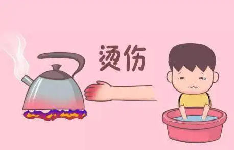 【疤痕科普】烫伤疤痕的防治要点 图片-2