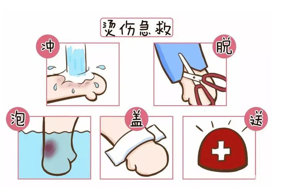 【疤痕科普】烫伤疤痕的防治要点 图片-6