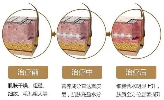 如何改善暗沉肤色? 图片-4