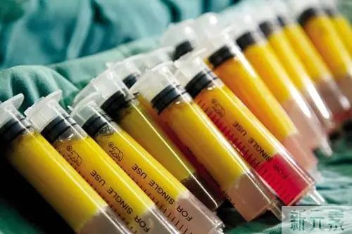 哪种除皱方式更适合你? 图片-7
