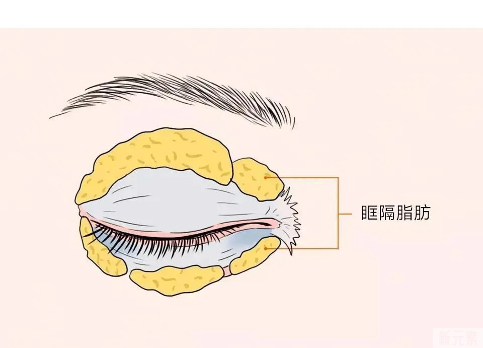 年轻人不长眼袋?这些祛眼袋的误区，你信了几个? 图片-15