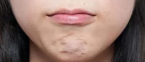 为什么都说下巴填充是成为美女的bi做项目? 图片-6