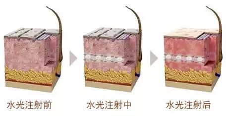 夏季水光肌养成攻略，净透亮白让你美到发光 图片-6