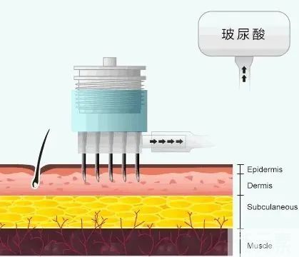 夏季水光肌养成攻略，净透亮白让你美到发光 图片-5