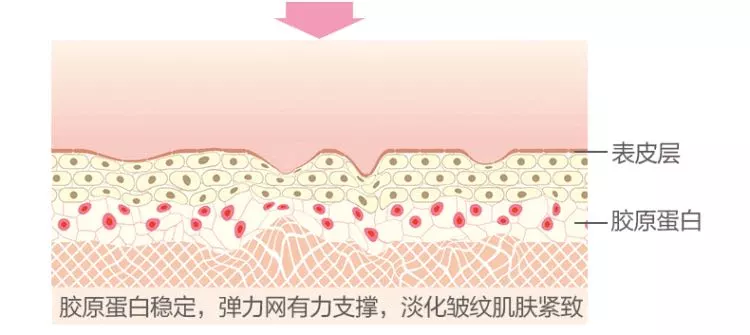 20岁做热玛吉会不会太早了? 图片-5
