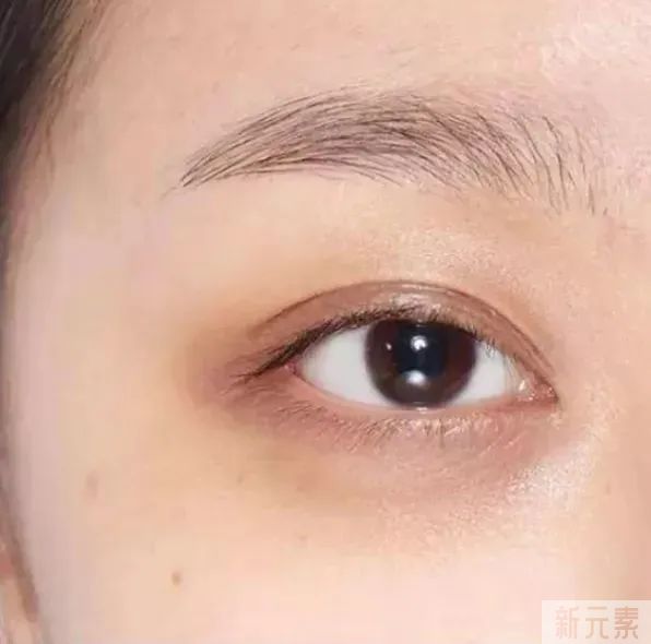 要睡多久觉，才能把黑眼圈睡没? 图片-3