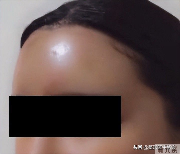 额头不饱满，影响“桃花运”吗? 图片-4