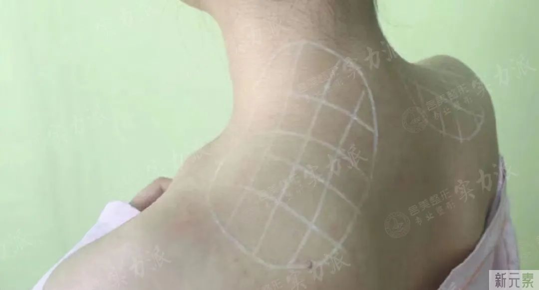 为什么同样的体重，你看起来更壮? 图片-13