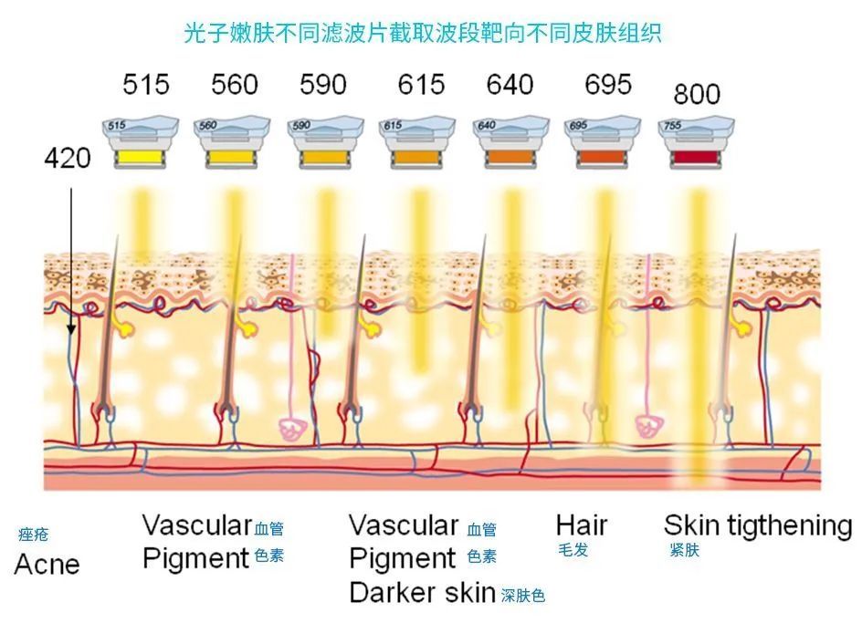 光子嫩肤究竟有没有「全模式」和「单模式」之分? 图片-3