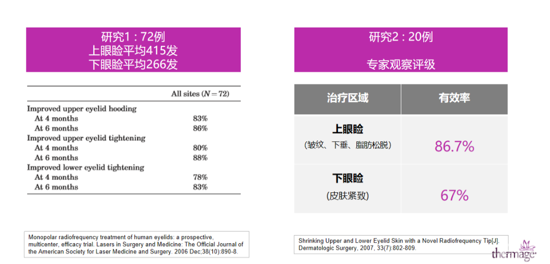 眼部热玛吉抗衰效果有多棒?临床数据告诉你! 图片-6