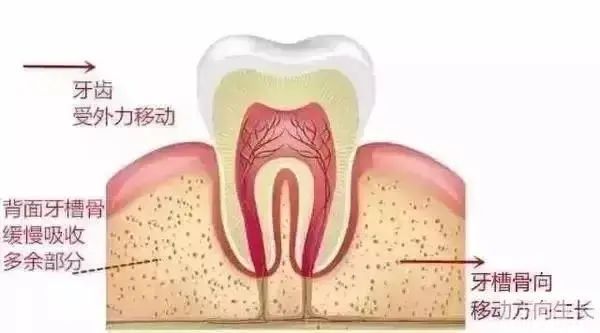 牙齿矫正科普，速来围观! 图片-2