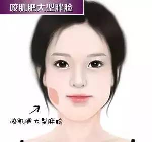 瘦脸针:一针解你愁，三针从此不再愁! 图片-4