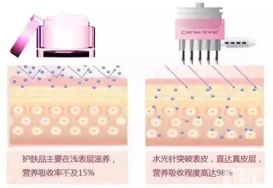 水光补水怎么选择适合自己的?一招让你摆脱“选择焦虑症” 图片-7