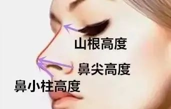 还在想怎么隆鼻?保姆级隆鼻攻略在这里! 图片-8