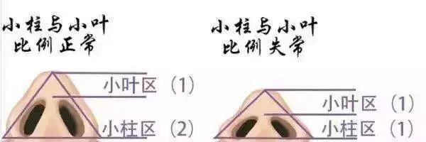 还在想怎么隆鼻?保姆级隆鼻攻略在这里! 图片-3