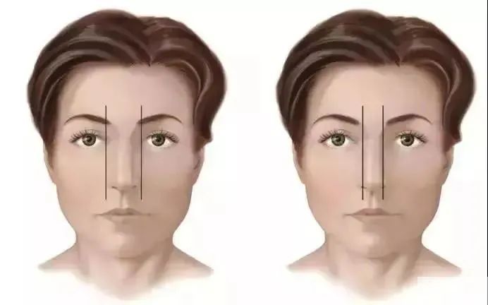 蒜头鼻、朝天鼻、鹰钩鼻...鼻头难看怎么破? 图片-5