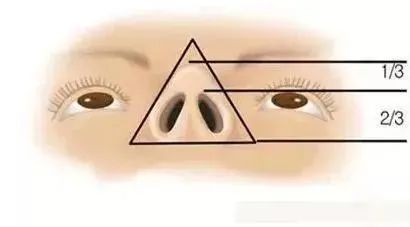 蒜头鼻、朝天鼻、鹰钩鼻...鼻头难看怎么破? 图片-4