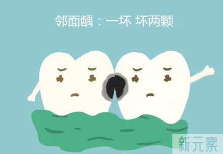 科普来了 | 牙齿发黑也不一定是蛀牙，那究竟是怎么回事? 图片-8