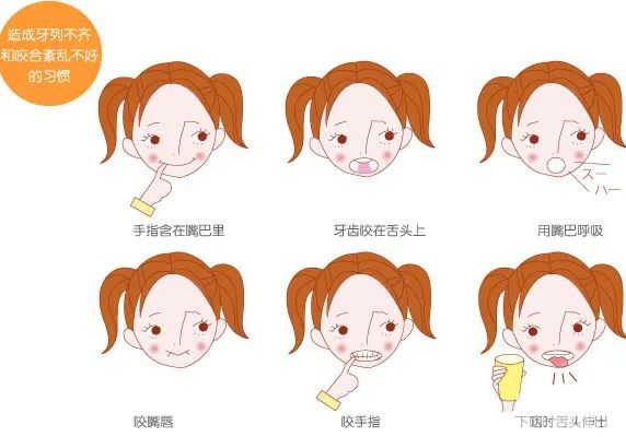 科普 | 地包天错过最佳治疗时机怎么办? 图片-7