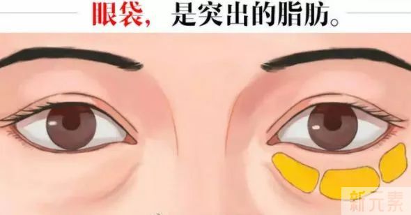 困扰无数女生的「眼袋智商税」，你都交了没? 图片-6