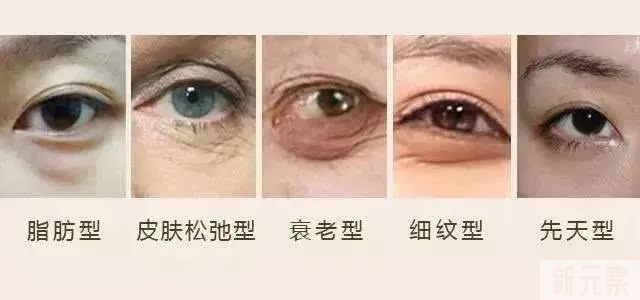 困扰无数女生的「眼袋智商税」，你都交了没? 图片-13