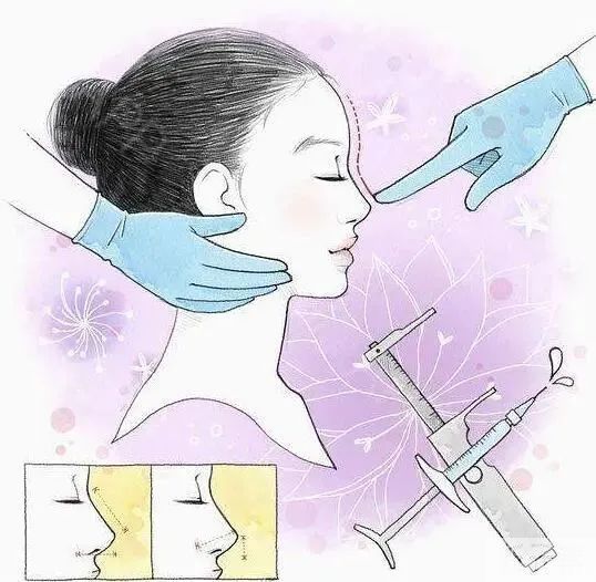 隆鼻自然不违和的秘诀!这样做，“ 后天翘鼻” 也能宛若ma生! 图片-3
