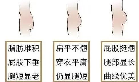 妈妈臀秒变蜜桃臀的方法，快来get! 图片-1