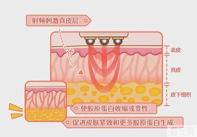 护肤不能只顾脸面，小心拖你后腿 图片-8
