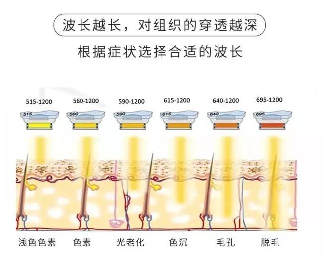 不同年龄段做光子嫩肤应该怎么选? 图片-8