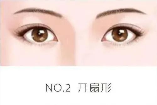 割双眼皮前，你需要做好这些攻略 图片-8