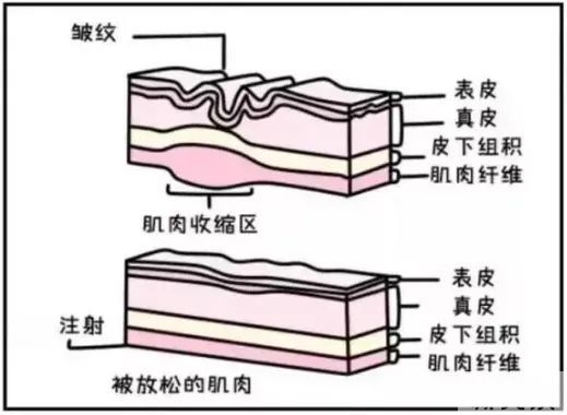眼袋、泪沟、黑眼圈...压垮颜值的三座大山，该如何拯救? 图片-9