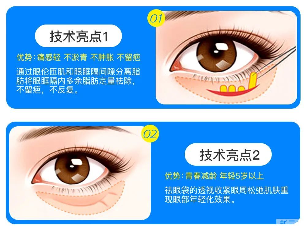 不开刀能祛眼袋?起初我是不信的!直到看到这个... 图片-5
