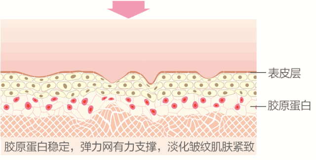这几种方式祛不了法令纹!不要再花冤枉钱了! 图片-18