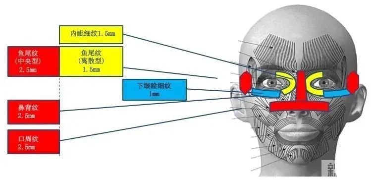 热拉提PLUS凭什么叫“mini热玛吉”? 图片-6