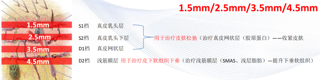 热拉提PLUS凭什么叫“mini热玛吉”? 图片-7