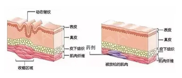 法令纹越来越深怎么办? 图片-6