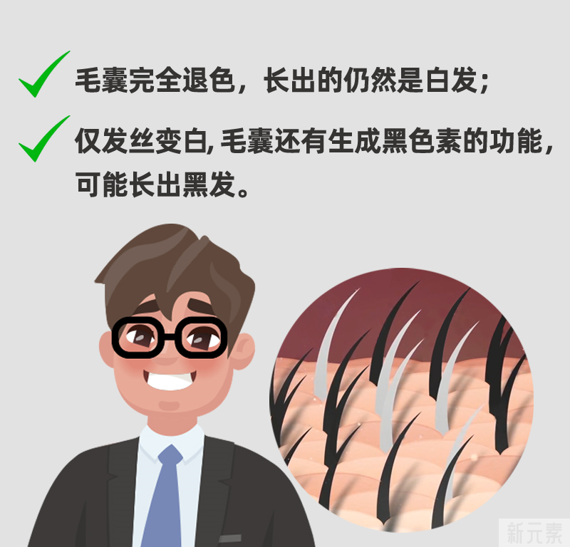 白发能植发吗?移植后会变黑吗? 图片-1