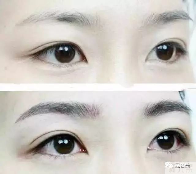 科普丨为什么大家都说眉毛、美瞳线一起做才好? 图片-3