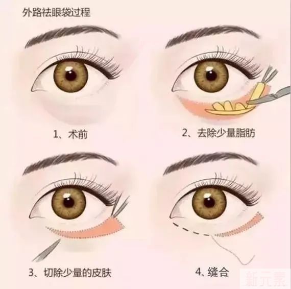 熬夜党自救指南! 图片-5