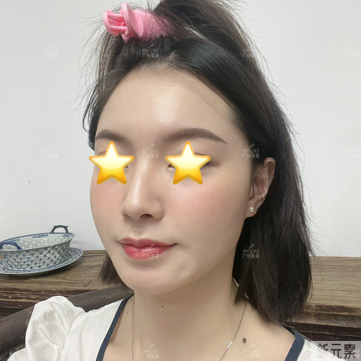 美白救急法:黄黑皮不看，我超伤心的OK?! 图片-8