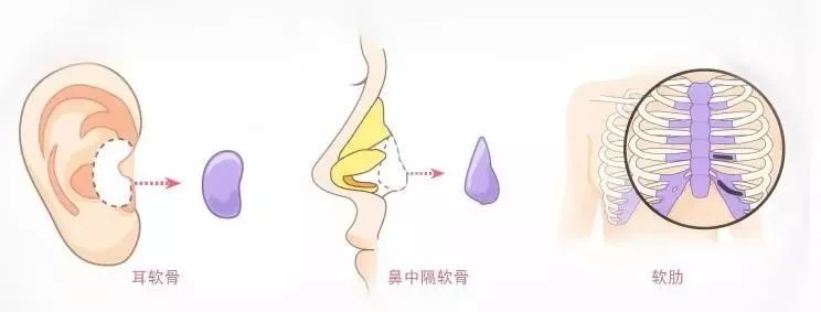 怎样才能做出一个好看的鼻子?这篇攻略请拿好! 图片-12