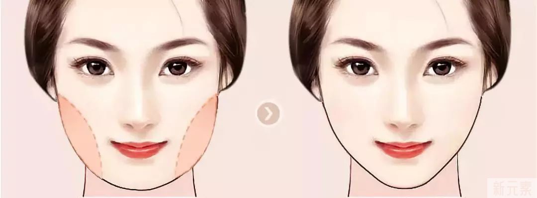 瘦瘦瘦—什么是吸脂?你真的了解吗? 图片-6