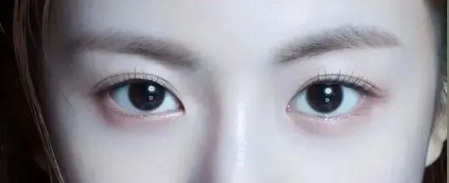 到底哪一种双眼皮才更加适合你?戳进来看个明白! 图片-9