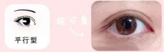 到底哪一种双眼皮才更加适合你?戳进来看个明白! 图片-7
