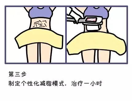 酷塑冷冻减脂，躺着就能瘦?到底是噱头还是黑科技? 图片-17