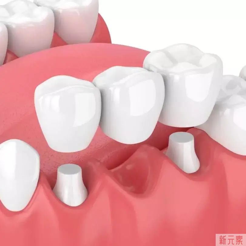 缺牙后如何避免骨吸收?我们从3种修复方式的吸收数据中找到了答案! 图片-7